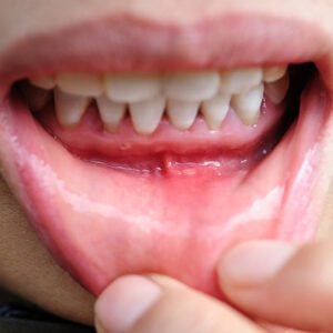 - Ascend Dental